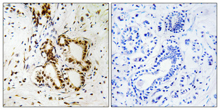 IHC - NF2 Polyclonal Antibody AP71263